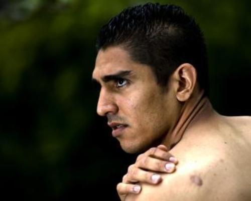 Jorge Claros: Pemain Honduras yang Pernah Tertembak di Kepala
